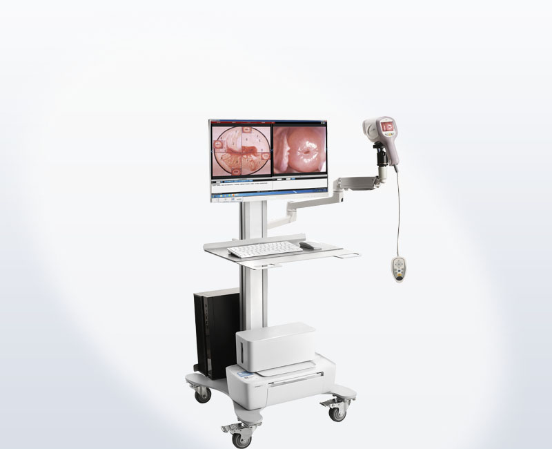 kn-2200i video colposcope